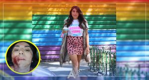 Atacan con arma blanca a la activista transgénero Natalia Lane